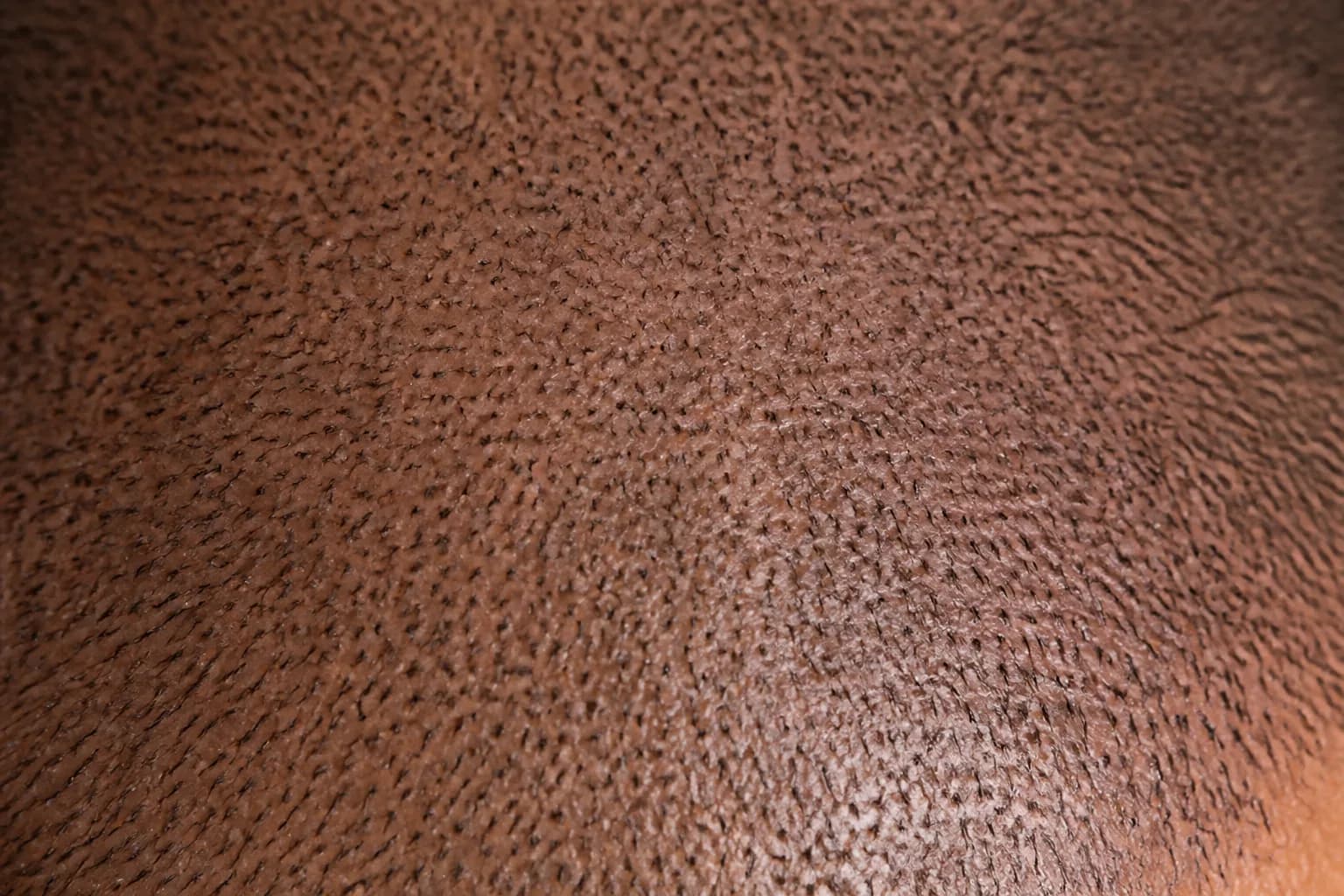 Close-up of scalp micropigmentation pigment dots